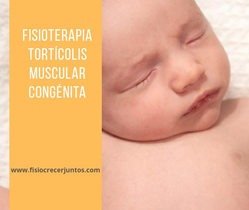 FISIOTERAPIA EN TORTÍCOLIS MUSCULAR CONGÉNITA